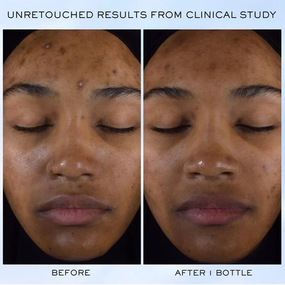 $13❤️‍🔥 Lancôme Clarifique Pro-Solution Brightening & Dark Spot Reducing Serum - Picture 6 of 12